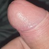 Fotka