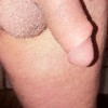 Fotka