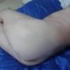 Fotka