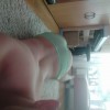 Fotka