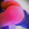 Fotka