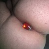 Anal