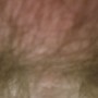 Penis876